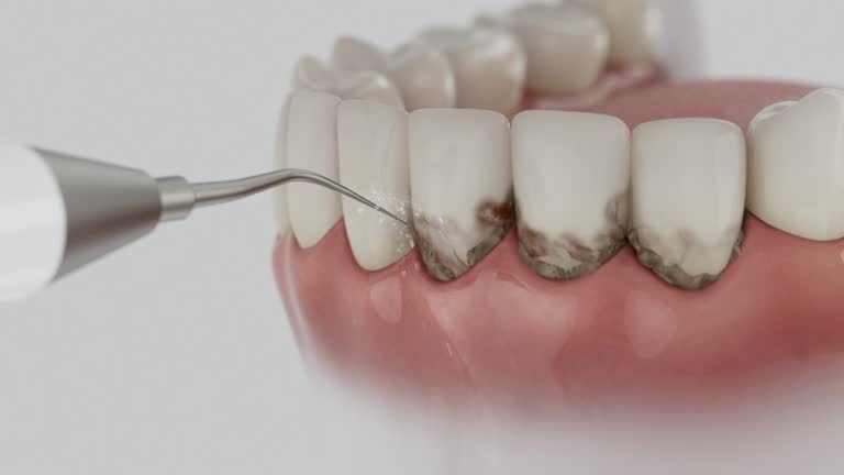 Reliable Tooth Extraction contractor in Colquitt County County, GA by Dentist Open Now